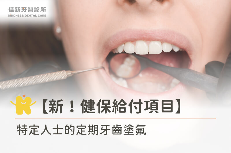 【新！健保給付項目】特定人士的定期牙齒塗氟